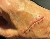 Check out this awesome before and after!