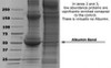 AlbuVoid™ - Albumin Depletion and Low Abundance Protein Enrichment Kit from Serum, Plasma, Tissues And Culture Media