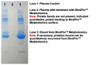 NuGel™ BindPro™ - Protein Removal & Enrichment of Metabolites/Analytes From Serum or Plasma