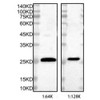 Dystrophin (DMD) Antibody