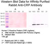 Rabbit Anti-Human CRP (C-Reactive Protein) Affinity Pure