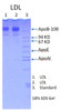 Human Low Density Lipoprotein (LDL), 50% glycerol