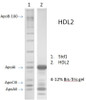Human High Density Lipoprotein 2 (HDL-2), 50% glycerol
