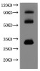 Recombinant Human Claudin-18.2 (CLDN18.2)-VLPs (Active)