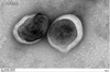 Recombinant Human Claudin-18.2 (CLDN18.2)-VLPs (Active)