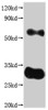 Recombinant Human Claudin-18.2 (CLDN18.2)-VLPs (Active)