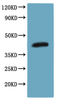 Recombinant Human C-C chemokine receptor type 8 (CCR8) - VLPs (Active)