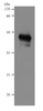 Recombinant Human B-lymphocyte antigen CD20 (MS4A1) - VLPs (Active)