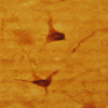 IHC image of neurons staining for 5-H1AA in the raphe nucleus of the rat brainstem. The tissue was fixed with 4% formaldehyde in phosphate buffer, before being removed and prepared for vibratome sectioning. Floating sections were incubated at RT in 10% goat serum in PBS, before standard IHC procedure. Primary antibody was incubated at 1:5000 for 48 hours, goat anti-rabbit secondary was subsequently added for 1 hour after washing with PBS. Light microscopy staining was achieved with standard biotin-streptavidin/HRP procedure and DAB chromogen.