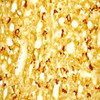 IHC image of neurons staining for ACTH in the rat anterior pituitary gland. The tissue was fixed with 4% formaldehyde in 0.1 M phosphate buffer, before being removed and prepared for frozen sectioning. Sections were incubated at RT in 10% goat serum in PBS, before standard IHC procedure. Primary antibody was incubated at 1:1000 for 48 hours, goat anti-rabbit secondary was subsequently added for 1 hour after washing with PBS. Light microscopy staining was achieved with standard biotin-streptavidin/HRP procedure and DAB chromogen.