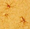 IHC image of astrocytes staining for GFAP in the rat cortex and human cortex . Rat tissue was fixed with 4% formaldehyde in phosphate buffer, before being removed and prepared for vibratome sectioning. Human tissue was formalin fixed and embedded in paraffin with microwave antigen retrieval. Sections were incubated at RT in 10% goat serum in PBS, before standard IHC procedure. Primary antibody was incubated at 1:500 for 48 hours, goat anti-rabbit secondary was subsequently added for 1 hour after washing with PBS. Light microscopy staining was achieved with standard biotin-streptavidin/HRP procedure and DAB chromogen.