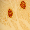 IHC image of beta cells in the islets of Langerhans of the rat pancreas staining for insulin and counterstained with hemotoxylin . The tissue was fixed with 4% formaldehyde in phosphate buffer, before being removed and prepared for frozen sectioning. Sections were incubated at RT in 10% goat serum in PBS, before standard IHC procedure. Primary antibody was incubated at 1:5000 for 48 hours, goat anti-rabbit secondary was subsequently added for 1 hour after washing with PBS. Light microscopy staining was achieved with standard biotin-streptavidin/HRP procedure and DAB chromogen