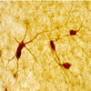 IHC image of neurons staining for neuropeptide Y in the rat cortex and striatum . The tissue was fixed with 4% formaldehyde in phosphate buffer, before being removed and prepared for vibratome sectioning. Floating sections were incubated at RT in 10% goat serum in PBS, before standard IHC procedure. Primary antibody was incubated at 1:5000 for 48 hours, goat anti-rabbit secondary was subsequently added for 1 hour after washing with PBS. Light microscopy staining was achieved with standard biotin-streptavidin/HRP procedure and DAB chromogen.
 
 The second image above entitled “C.” is NPY interneurons (RED) in mouse striatum, GREEN staining is GFP expressed by medium spiny neurons provided Alipi Naydenov, Neurobiology and Behavior, Stella Lab University of Washington (see review below).