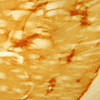 IHC image of mu opioid receptor staining in the rat striatum. The tissue was fixed with 4% formaldehyde in phosphate buffer, before being removed and prepared for vibratome sectioning. Floating sections were incubated at RT in 10% goat serum in PBS, before standard IHC procedure. Primary antibody was incubated at 1:10000 for 48 hours, goat anti-rabbit secondary was subsequently added for 1 hour after washing with PBS. Light microscopy staining was achieved with standard biotin-streptavidin/HRP procedure and DAB chromogen.