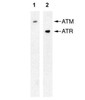 ATR antibody [2B5] | GTX70109