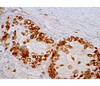 Anti-p53 Antibody (DO-1) | SC-126