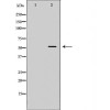 ACVR1C antibody | orb228253