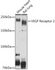 VEGF Receptor 2 Rabbit pAb | A11127