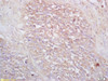 VPAC2R Polyclonal Antibody | BS-0197R