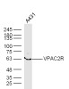 VPAC2R Polyclonal Antibody | BS-0197R