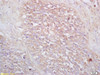 VPAC2R Polyclonal Antibody | GRP219