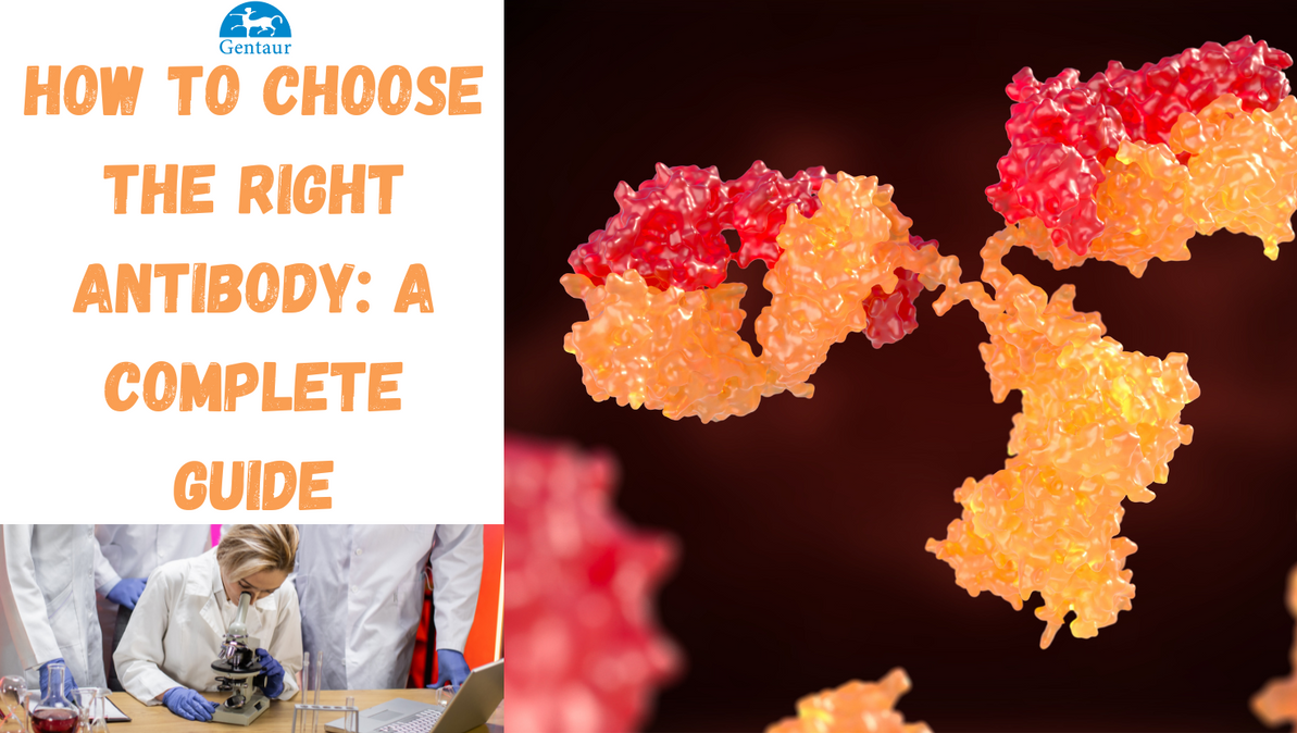 How to Choose the Right Antibody: A Complete Guide