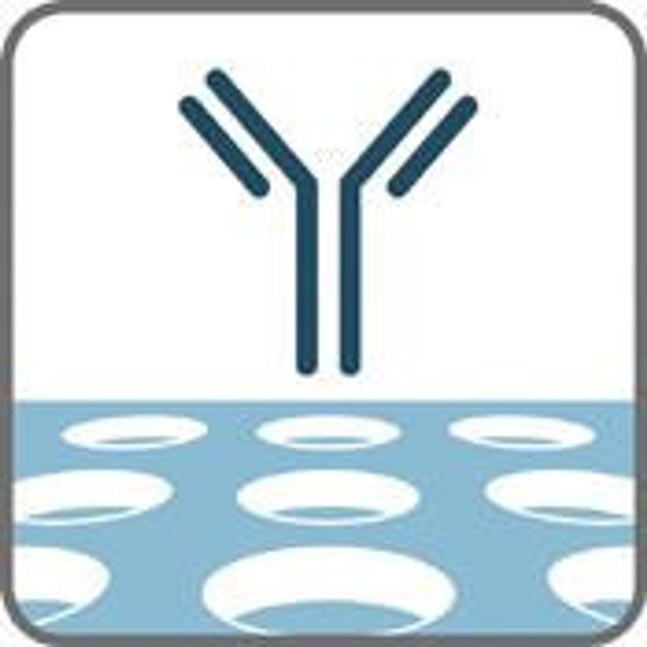 IdentiClone TCRB Gene Clonality Assay - ABI Fluorescence Detection,9 ...