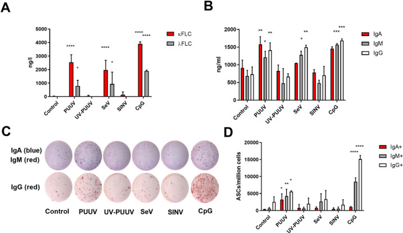 Immunoglobulin Free Chains Kappa and Lambda Human ELISA | RD194088100R