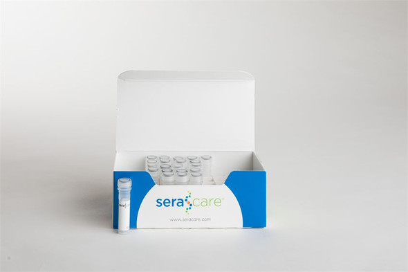 AccuSet™ HSV-1/2 Mixed Titer Performance Panel | Seracare