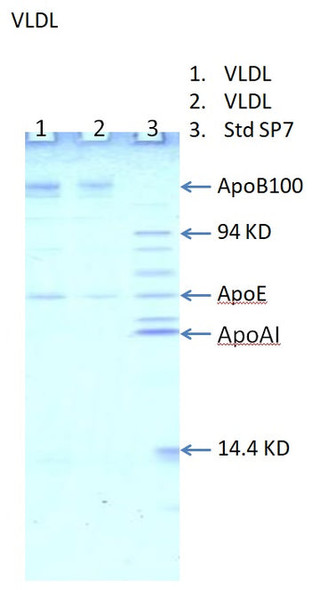 Human Very Low Density Lipoportein (VLDL), 50% glycerol