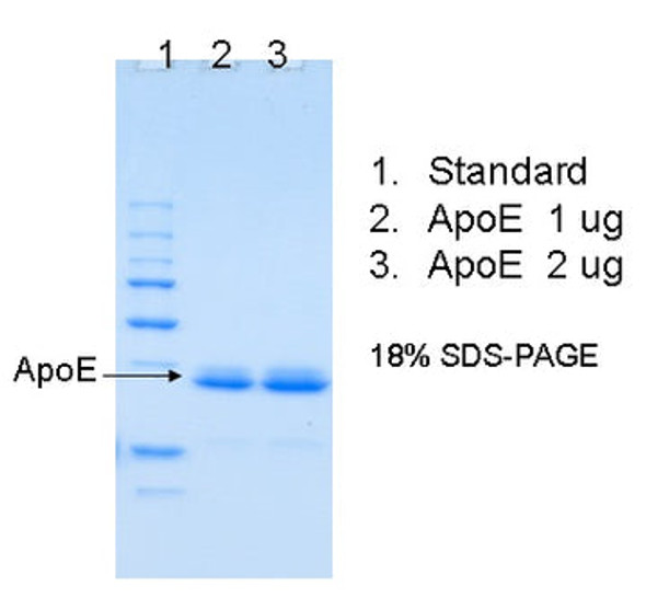 Human Apolipoprotein E (Apo E)