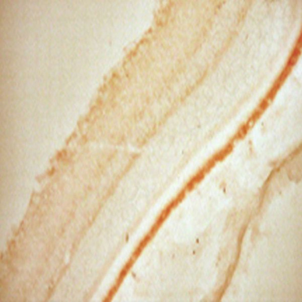 IHC image of rat retina staining for GABA transporter 2 (GAT-2). The tissue was fixed with 4% formaldehyde/0.05% glutaraldehyde in 0.1 M phosphate buffer, before being removed and prepared for vibratome sectioning. Floating sections were incubated at RT in 10% goat serum in PBS, before standard IHC procedure. Primary antibody was incubated at 1:1000 for 48 hours, goat anti-rabbit secondary was subsequently added for 1 hour after washing with PBS. Light microscopy staining was achieved with standard biotin-streptavidin/HRP procedure and DAB chromogen.