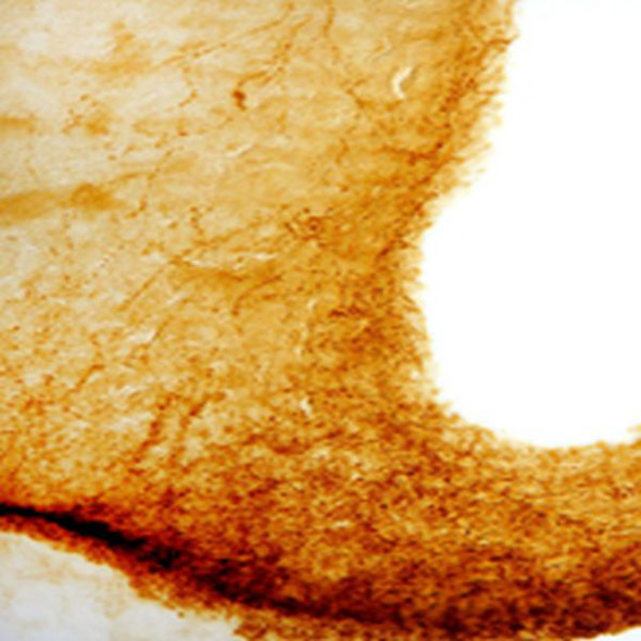 IHC image of staining for LNRH/GnRH in the rat median eminence. The tissue was fixed with 4% formaldehyde in phosphate buffer, before being removed and prepared for vibratome sectioning. Floating sections were incubated at RT in 10% goat serum in PBS, before standard IHC procedure. Primary antibody was incubated at 1:4000 for 48 hours, goat anti-rabbit secondary was subsequently added for 1 hour after washing with PBS. Light microscopy staining was achieved with standard biotin-streptavidin/HRP procedure and DAB chromogen.