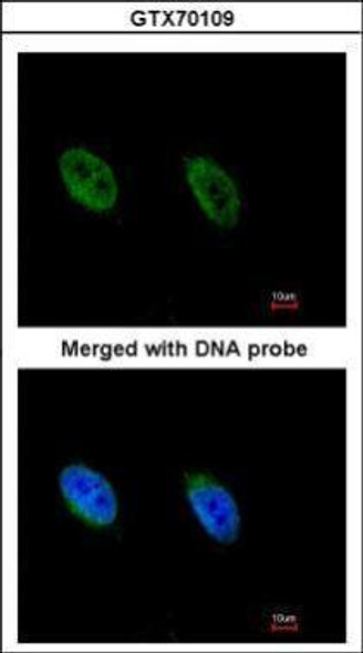 ATR antibody [2B5] | GTX70109