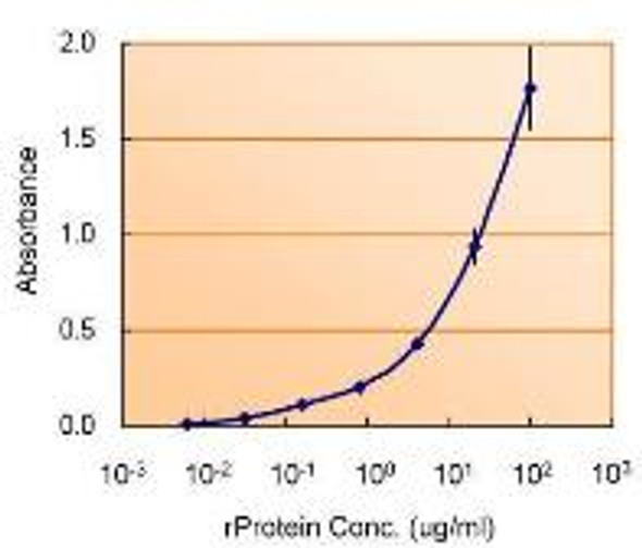 TSG101 antibody [4A10] | GTX70255