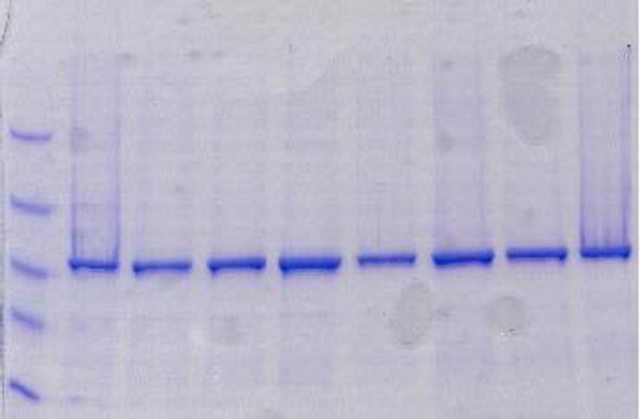 ProteoSpin™ Inclusion Body Protein Isolation Micro Kit | 10300