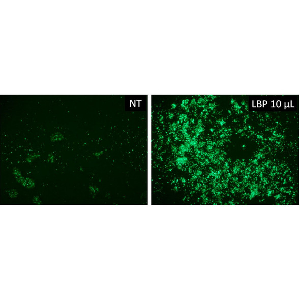 LentiBlast Premium Transduction Enhancer | LBPX