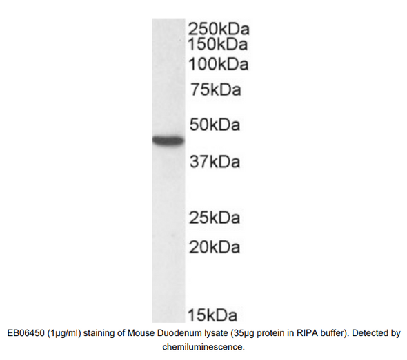 Goat Anti-Smooth muscle alpha-actin Antibodyy | EB06450