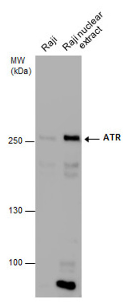 ATR antibody [2B5] | GTX70109