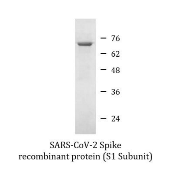 SARS-CoV-2 Spike recombinant protein (S1 Subunit) (His-tagged, Cter) | ARG70218