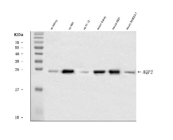 Anti-Aquaporin 2/AQP2 Antibody Picoband™ | PB9474