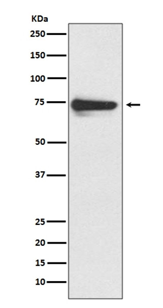 Anti-Tyrosinase Rabbit Monoclonal Antibody | EM00326-1