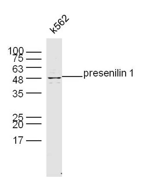 Presenilin 1 Polyclonal Antibody | BS-0024R