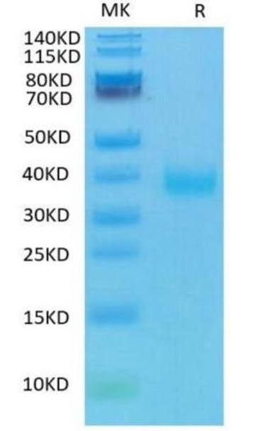 Recombinant SARS-CoV-2 Spike RBD | bs-46003P