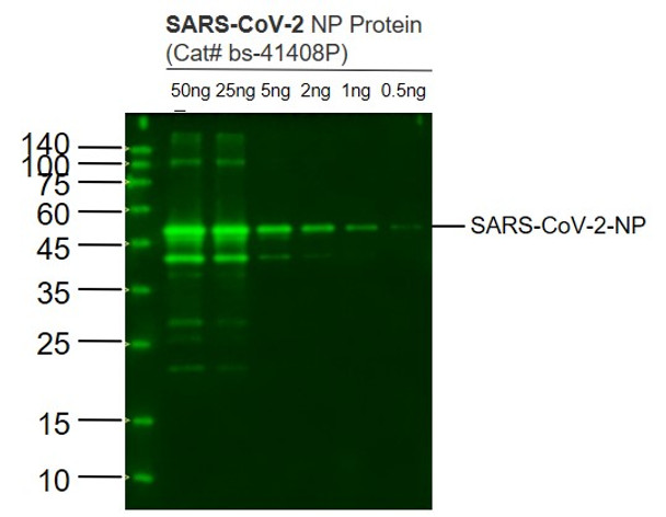 SARS-CoV-2 Nucleocapsid Protein (1C7) Monoclonal Antibody | bsm-41411M