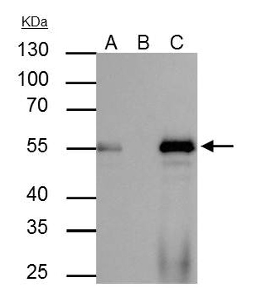 FOXA1 antibody | GRP6