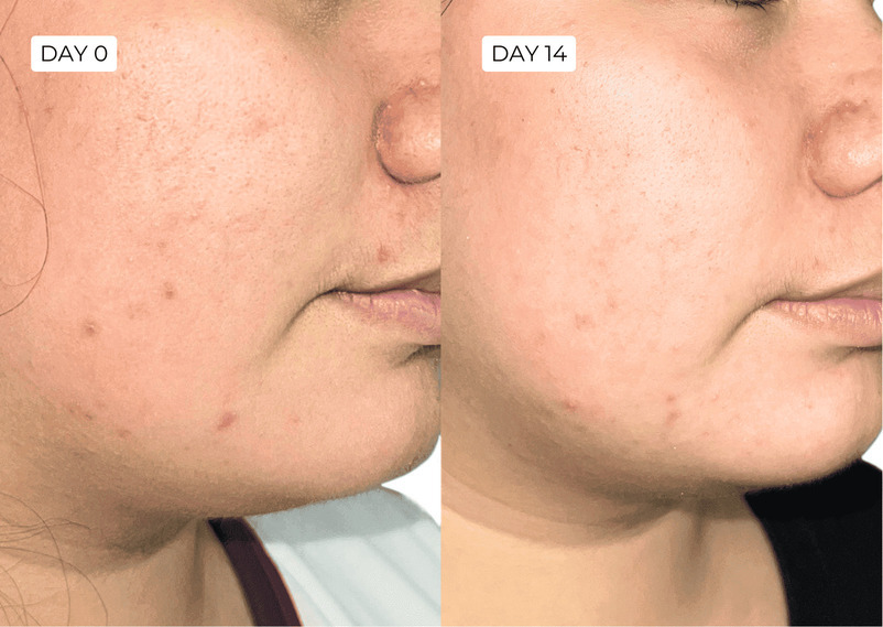 Before/after