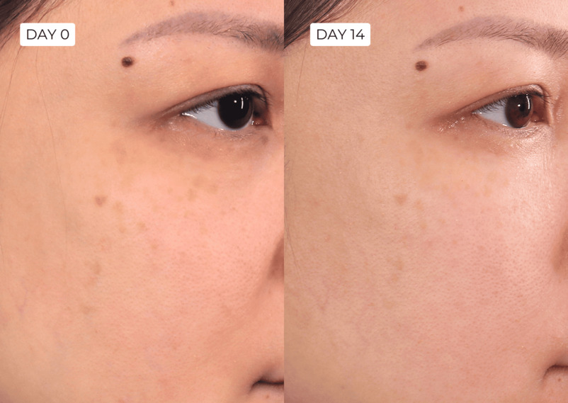 Before/after