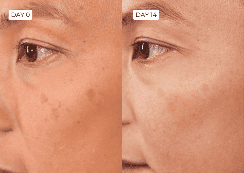 Before/after