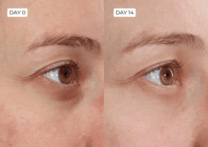 Before/after